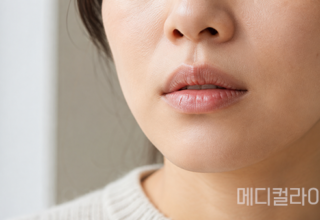 환절기 입술 자꾸 트고 갈라진다면…침 바르는 습관부터 살펴야