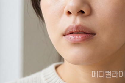 환절기 입술 자꾸 트고 갈라진다면…침 바르는 습관부터 살펴야